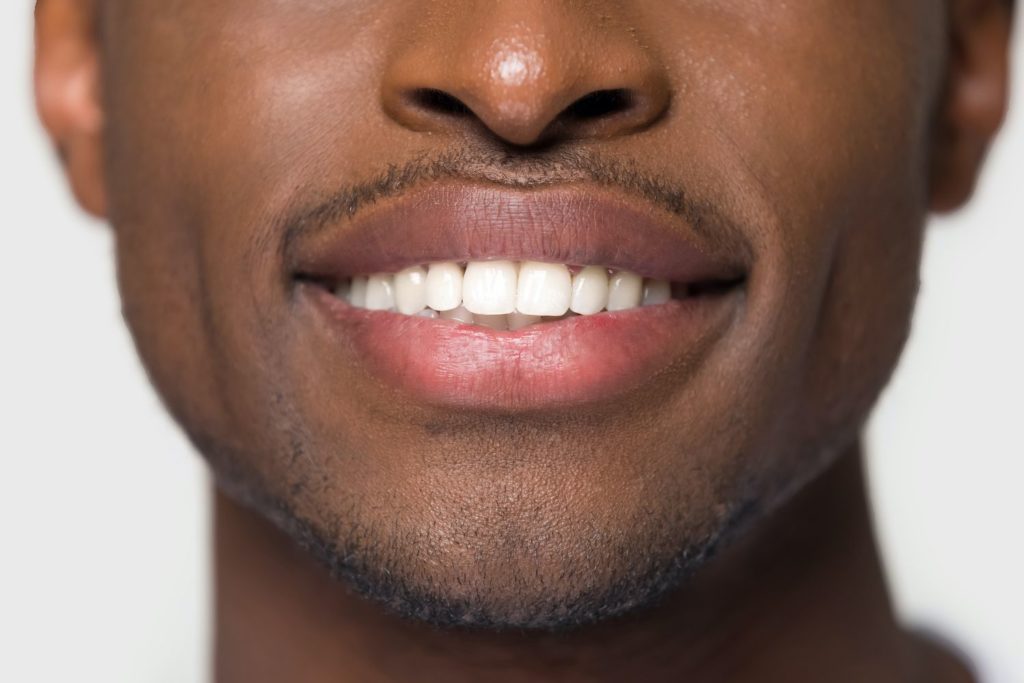 close up cropped image of young man with perfect white smile custom mouthguards general dentistry dentist in Owen's Cross Road Alabama